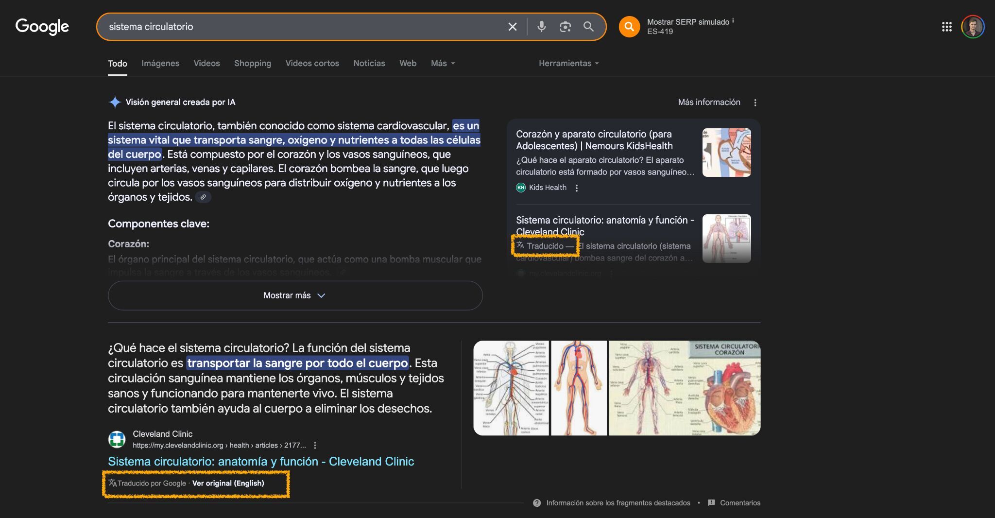 Proof of Google translating content without your consent. 